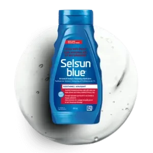Bottle of Selsun blue® Itchy Dry Scalp